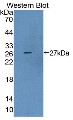 Invitrogen AUP1 Polyclonal Antibody:Antibodies:Primary Antibodies