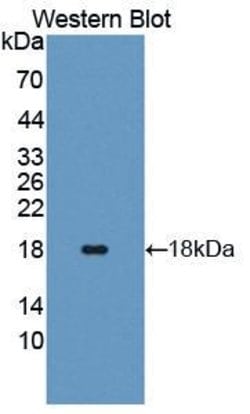 Invitrogen Angiogenin Polyclonal Antibody 20 &mu;L; Unconjugated:Antibodies,