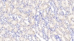 Invitrogen Angiogenin Polyclonal Antibody 20 &mu;L; Unconjugated:Antibodies,