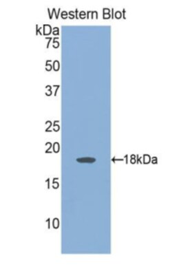 Invitrogen Angiopoietin 2 Polyclonal Antibody 20 &mu;L; Unconjugated:Antibodies,
