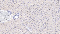 Invitrogen ANGPTL6 Polyclonal Antibody:Antibodies:Primary Antibodies