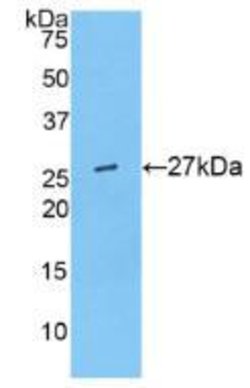 Invitrogen ANGPTL6 Polyclonal Antibody:Antibodies:Primary Antibodies