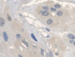 Invitrogen ANTXR2 Polyclonal Antibody 200 &mu;L; Unconjugated:Antibodies,