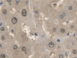 Invitrogen ANTXR2 Polyclonal Antibody 200 &mu;L | Buy Online | Invitrogen&trade; | Fisher Scientific