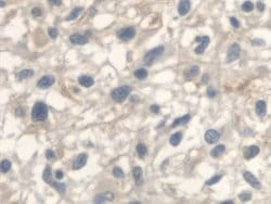 Invitrogen ANTXR2 Polyclonal Antibody 200 &mu;L; Unconjugated:Antibodies,
