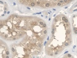 Invitrogen ANTXR2 Polyclonal Antibody 200 &mu;L; Unconjugated:Antibodies,