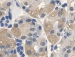 Invitrogen ANTXR2 Polyclonal Antibody 200 &mu;L; Unconjugated:Antibodies,