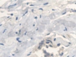 Invitrogen ANTXR2 Polyclonal Antibody 200 &mu;L; Unconjugated:Antibodies,