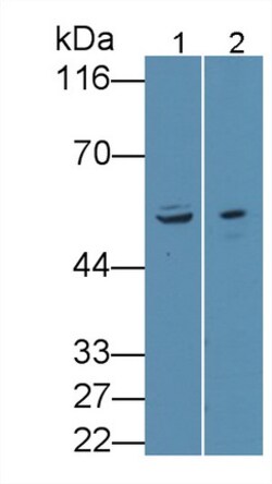 Invitrogen ANTXR2 Polyclonal Antibody 200 &mu;L | Buy Online | Invitrogen&trade; | Fisher Scientific
