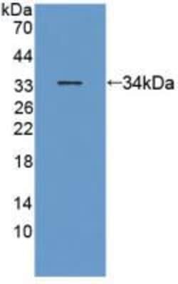 Invitrogen ANTXR2 Polyclonal Antibody 200 &mu;L; Unconjugated:Antibodies,