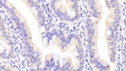Invitrogen APOA4 Polyclonal Antibody 20 &mu;L | Buy Online | Invitrogen&trade; | Fisher Scientific