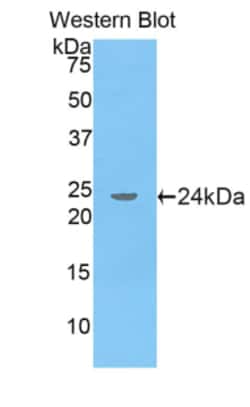 Invitrogen APOA5 Polyclonal Antibody 200 &mu;L; Unconjugated:Antibodies,