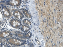 Invitrogen APOB Polyclonal Antibody:Antibodies:Primary Antibodies