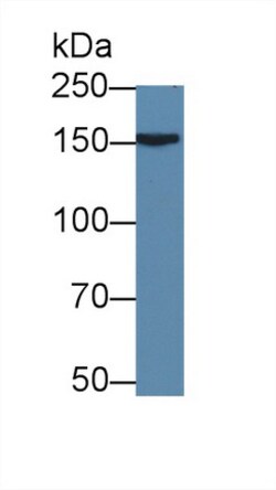 Invitrogen APOB Polyclonal Antibody:Antibodies:Primary Antibodies