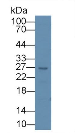 Invitrogen Artemin Polyclonal Antibody:Antibodies:Primary Antibodies