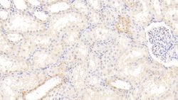 Invitrogen AHR Polyclonal Antibody 200 &mu;L | Buy Online | Invitrogen&trade; | Fisher Scientific