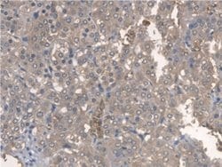 Invitrogen BMAL1 Polyclonal Antibody:Antibodies:Primary Antibodies
