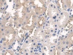 Invitrogen BMAL1 Polyclonal Antibody:Antibodies:Primary Antibodies