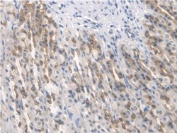 Invitrogen BMAL1 Polyclonal Antibody:Antibodies:Primary Antibodies