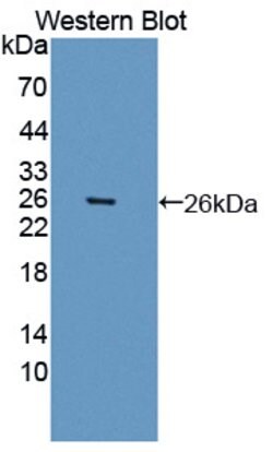 Invitrogen BMAL1 Polyclonal Antibody:Antibodies:Primary Antibodies