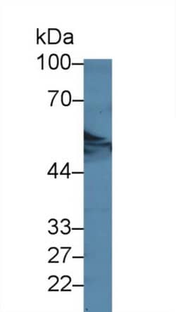 Invitrogen DARS Polyclonal Antibody 20 &mu;L; Unconjugated:Antibodies,