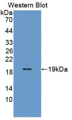 Invitrogen DARS Polyclonal Antibody 200 &mu;L; Unconjugated:Antibodies,