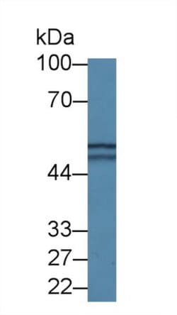 Invitrogen DARS Polyclonal Antibody 20 &mu;L; Unconjugated:Antibodies,