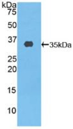 Invitrogen ABCA3 Polyclonal Antibody 20 &mu;L; Unconjugated:Antibodies,