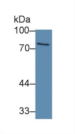 Invitrogen ABCB8 Polyclonal Antibody:Antibodies:Primary Antibodies