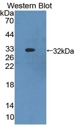 Invitrogen ABCB8 Polyclonal Antibody:Antibodies:Primary Antibodies