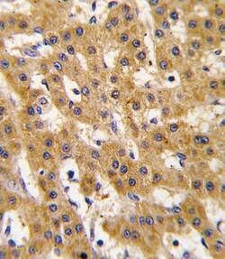 Invitrogen PDX1 Polyclonal Antibody 400 &mu;L; Unconjugated:Antibodies,