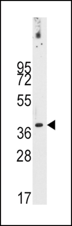 Invitrogen PDX1 Polyclonal Antibody 400 &mu;L; Unconjugated:Antibodies,