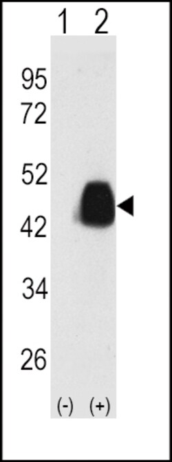 Invitrogen PDX1 Polyclonal Antibody 400 &mu;L; Unconjugated:Antibodies,
