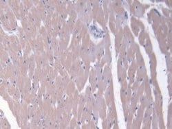 Invitrogen MRP6 Polyclonal Antibody 20 &mu;L; Unconjugated:Antibodies,