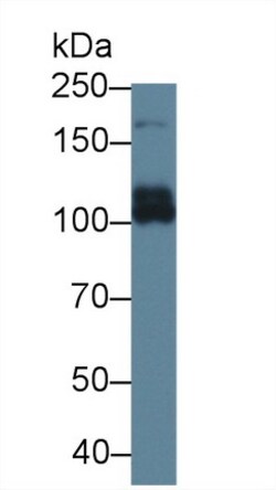 Invitrogen MRP6 Polyclonal Antibody:Antibodies:Primary Antibodies