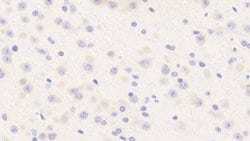 Invitrogen Aurora C Polyclonal Antibody:Antibodies:Primary Antibodies