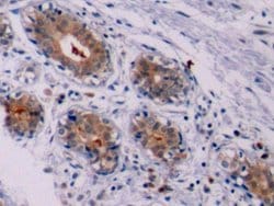 Invitrogen Bcl-2 Polyclonal Antibody:Antibodies:Primary Antibodies