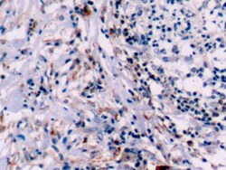 Invitrogen Bcl-2 Polyclonal Antibody:Antibodies:Primary Antibodies