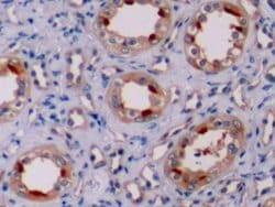 Invitrogen Bcl-2 Polyclonal Antibody:Antibodies:Primary Antibodies