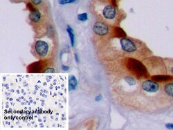 Invitrogen Bcl-2 Polyclonal Antibody:Antibodies:Primary Antibodies