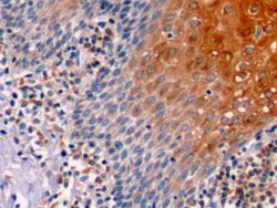 Invitrogen Bcl-2 Polyclonal Antibody:Antibodies:Primary Antibodies