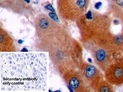 Invitrogen Bcl-2 Polyclonal Antibody:Antibodies:Primary Antibodies