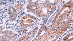 Invitrogen Bcl-2 Polyclonal Antibody:Antibodies:Primary Antibodies
