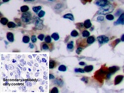 Invitrogen Bcl-2 Polyclonal Antibody:Antibodies:Primary Antibodies