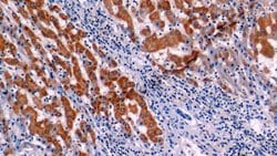 Invitrogen Bcl-2 Polyclonal Antibody:Antibodies:Primary Antibodies