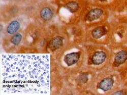 Invitrogen Bcl-2 Polyclonal Antibody:Antibodies:Primary Antibodies