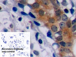 Invitrogen Bcl-2 Polyclonal Antibody:Antibodies:Primary Antibodies
