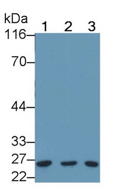 Invitrogen Bcl-2 Polyclonal Antibody:Antibodies:Primary Antibodies