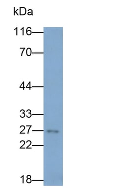 Invitrogen Bcl-2 Polyclonal Antibody:Antibodies:Primary Antibodies