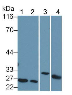 Invitrogen Bcl-2 Polyclonal Antibody:Antibodies:Primary Antibodies